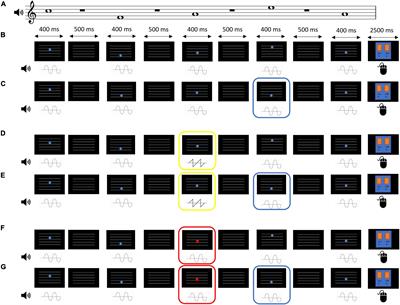 Computerized Music-Reading Intervention Improves Resistance to Unisensory Distraction Within a Multisensory Task, in Young and Older Adults